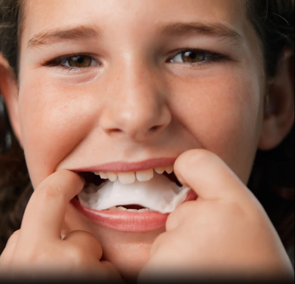 a child showing how to insert the Invisalign Palatal Expander
